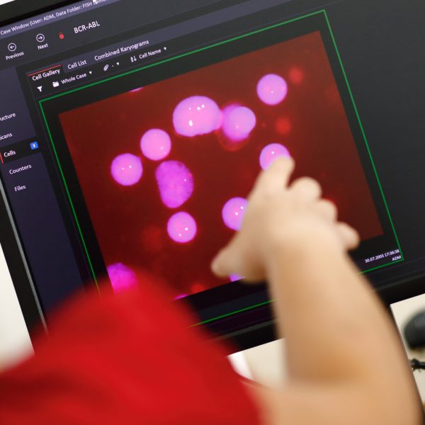 Close-up of a computer screen displaying fluorescent cell images in a scientific software interface, with a person pointing at the screen, partially visible in the foreground.