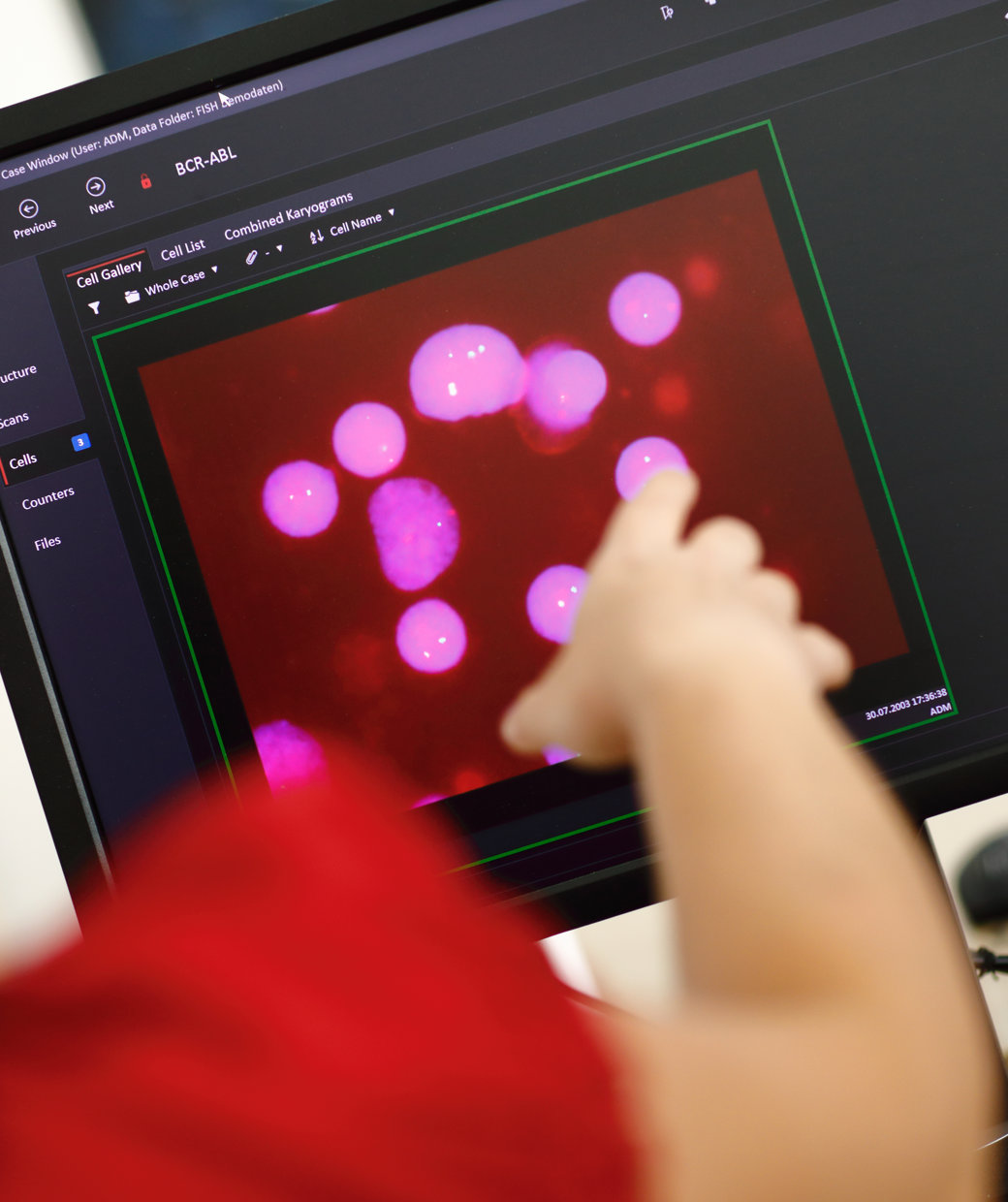 Close-up of a computer screen displaying fluorescent cell images in a scientific software interface, with a person pointing at the screen, partially visible in the foreground.